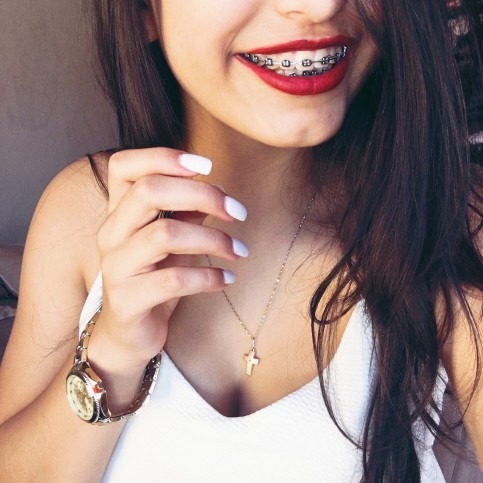 Girl with Braces